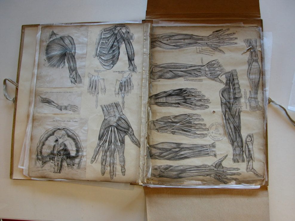 Conservation and rehousing of a group of bound medical drawings