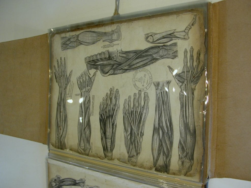 Conservation and rehousing of a group of bound medical drawings